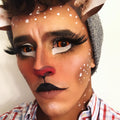 Radioactive Sclera Contacts