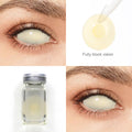 Blind Yellowish Sclera Contacts - PsEYEche